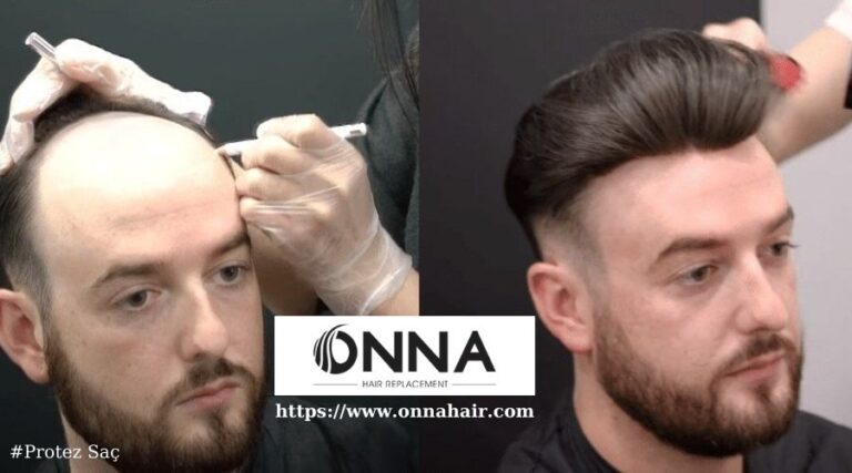 Protez Saçta Saçın Parlaklığını Koruma İpuçları